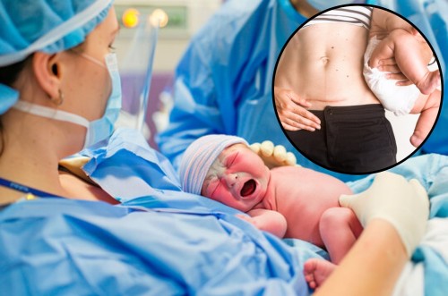 C-section